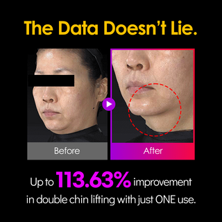 [No.1 K-Beauty Device] mmcr EMS V-THERA
